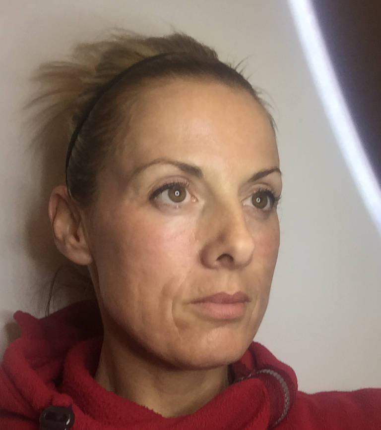 6 hours after treatment