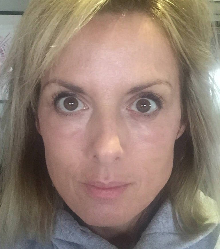 Morning after treatment with light makeup