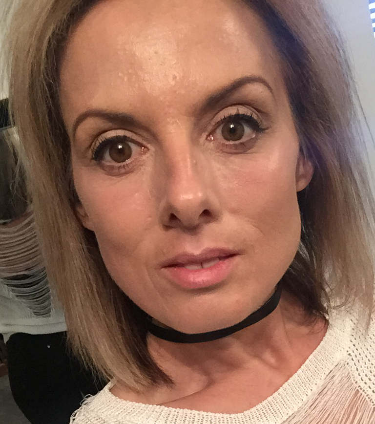 1 week after treatment